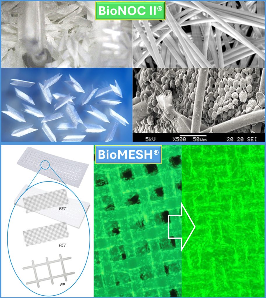 BioNocBiomesh_Carriers
